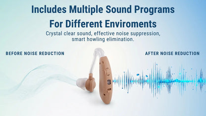Zingle Auden – Behind-the-Ear Rechargeable Hearing Amplifier