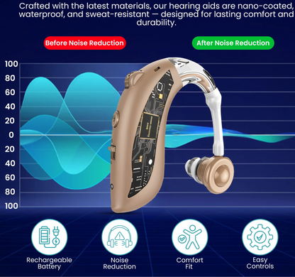 Zingle Sonara – Behind-the-Ear (BTE) Hearing Amplifiers, Rechargeable with Charging Dock